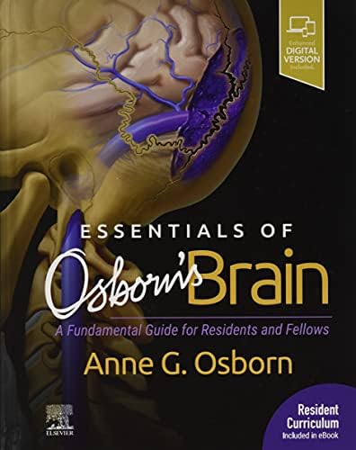 Osborn's Brain 第2版 Osborn's Brain: 9780323477765: Medicine & Health Science Books